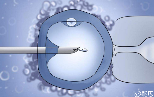 试管婴儿移植后  同房时间